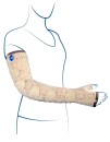 mobiderm_autofit_arm 2.png