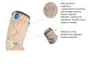 Rekaw-uciskowy-MOBIDERM-Autofit-zapinany-na-rzepy-nocdzien_1.png
